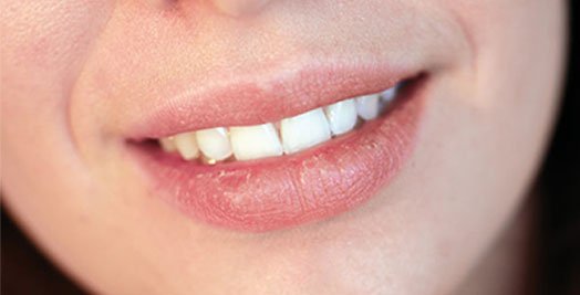 dry mouth treatment canley heights