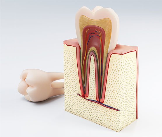 root canal treatment canley heights