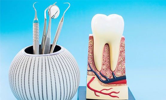 root canal treatments blurb canley heights