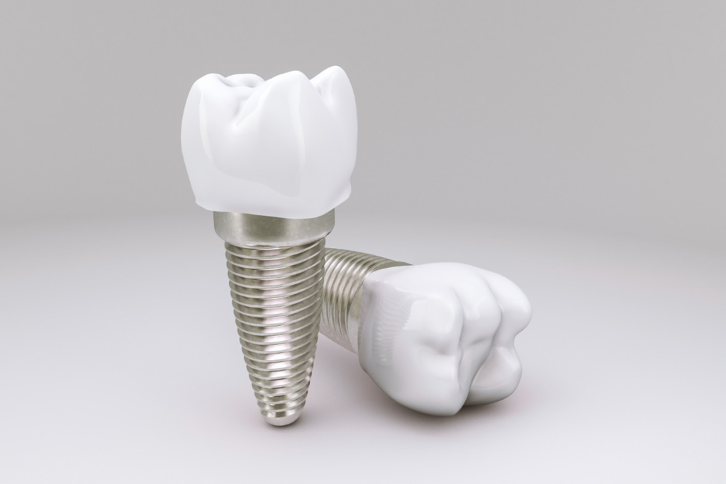 all you need to know about dental implants canley heights dental care
