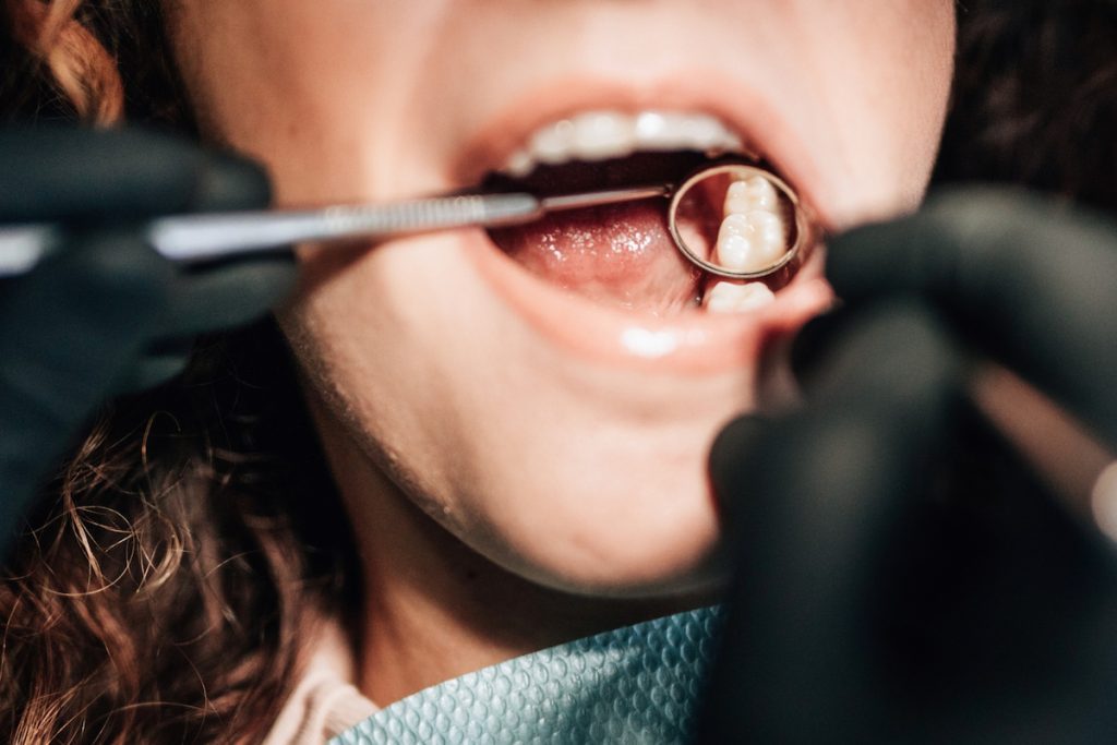 exploring the advantages of porcelain fillings for tooth repair