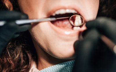Beyond Metal: Exploring the Advantages of Porcelain Fillings for Tooth Repair